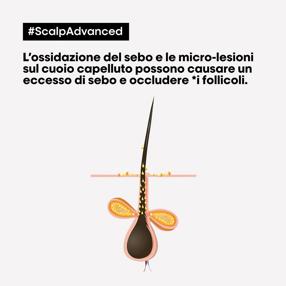 L'oreal Professionnel Scalp Advanced 2-in-1 Deep Purifier Clay Anti-Oiliness 250 ml - Image 2