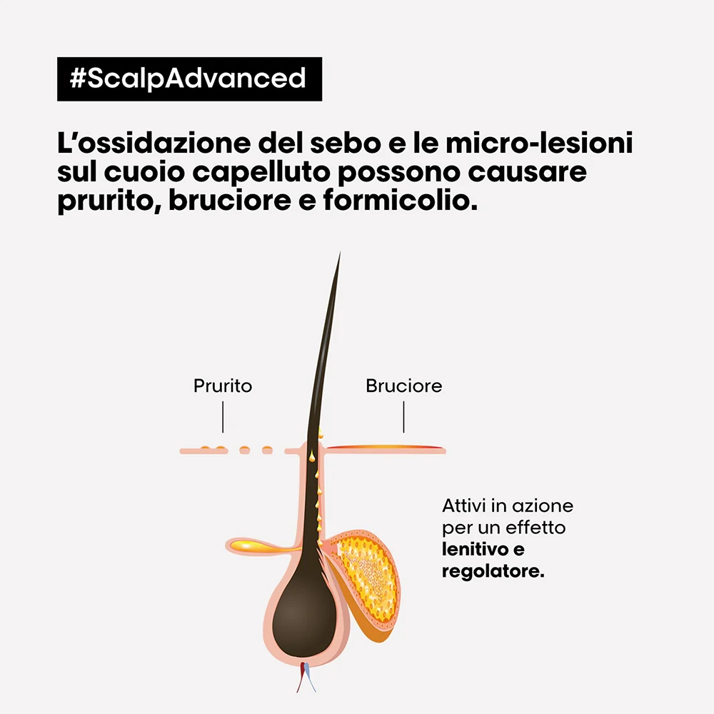 L'oreal Professionnel Scalp Advanced Anti-Discomfort 300 ml - Image 2
