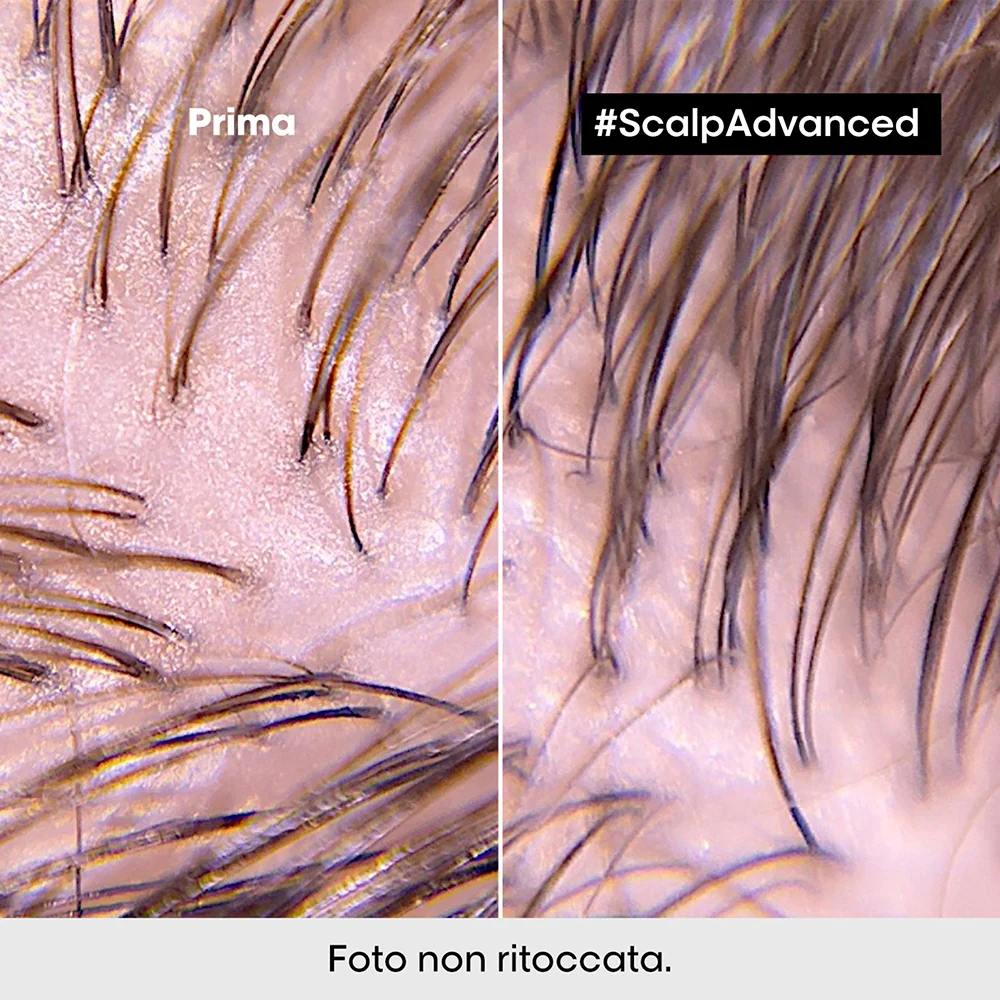 L'oreal Professionnel Scalp Advanced Anti-Oiliness 300 ml - Image 4